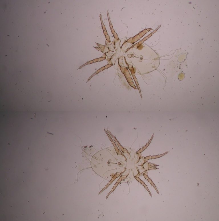 Dwa zdjęcia mikroskopowe jasnobrązowego roztocza na jasnym tle, ukazujące jego segmentowane odnóża i owalne ciało z drobnymi włoskowatymi strukturami.