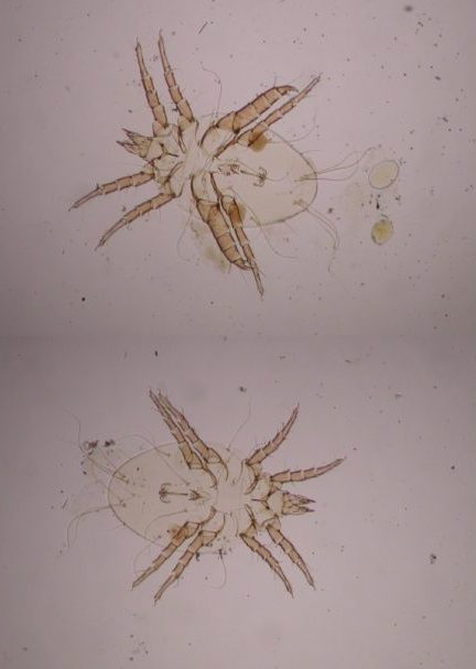 Dwa zdjęcia mikroskopowe jasnobrązowego roztocza na jasnym tle, ukazujące jego segmentowane odnóża i owalne ciało z drobnymi włoskowatymi strukturami.